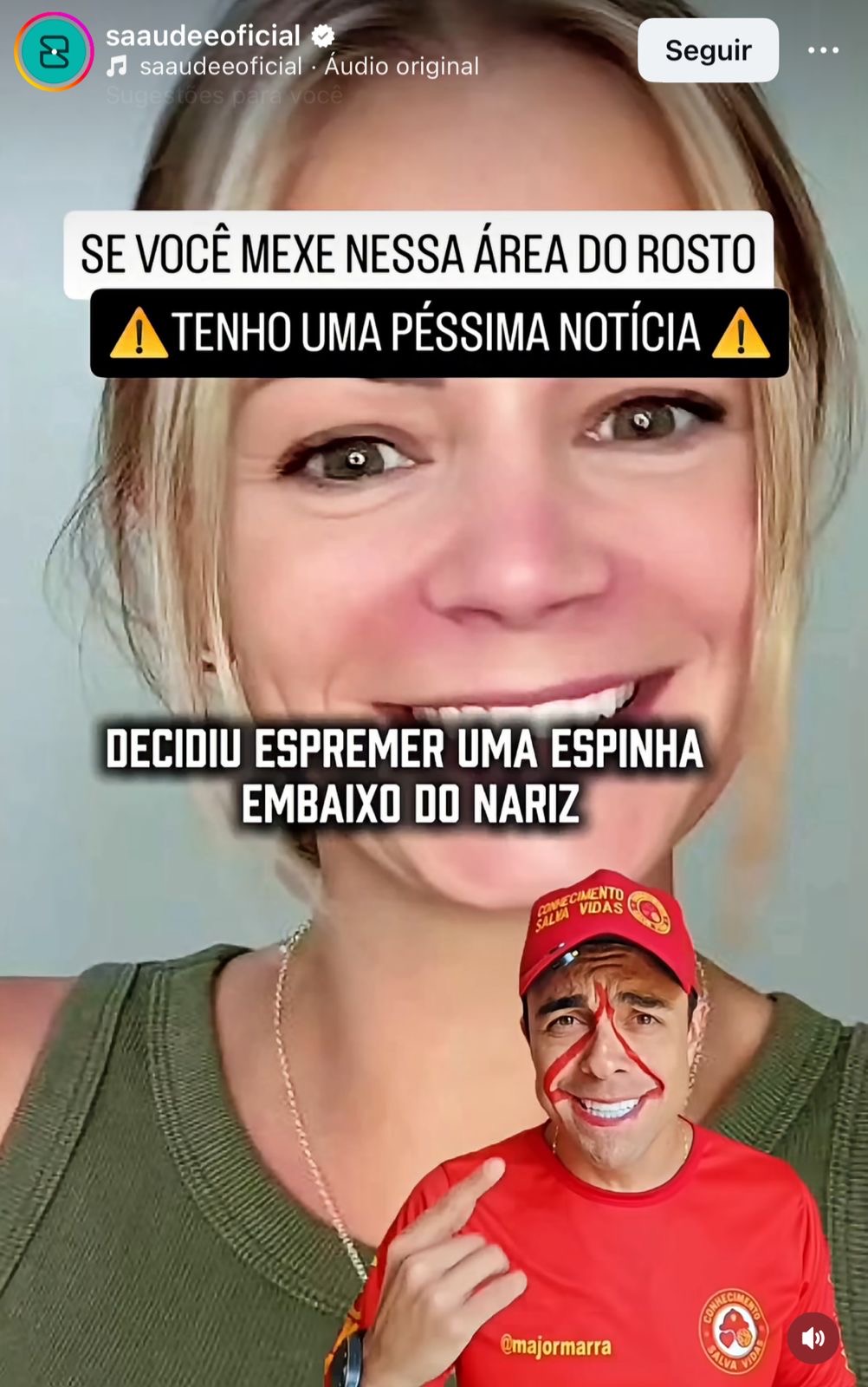 ESPREMER ESPINHAS NESSA REGIÃO DO ROSTO PODE TRAZER RISCOS À SAÚDE, ALERTAM ESPECIALISTAS